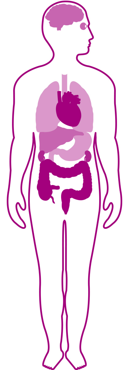 Human body outline displaying areas where the polyneuropathy of hATTR amyloidosis can manifest